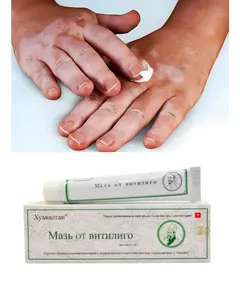 Мазь от Витилиго, 20 г.